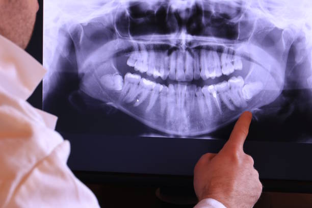 Best Emergency Gum Treatment in The Village Of Indian Hill, OH