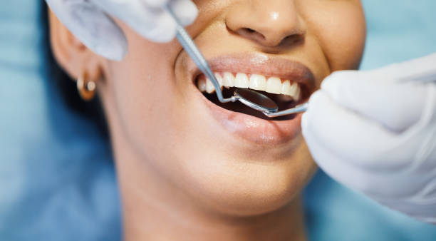 Best Emergency Dental Care for Broken or Chipped Teeth in The Village Of Indian Hill, OH