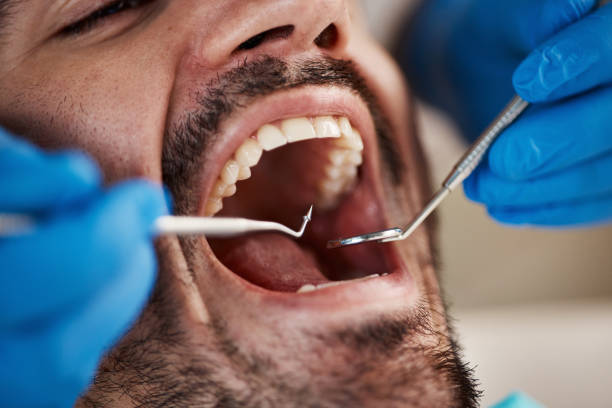 Best Urgent Care for Lost Fillings or Crowns in The Village Of Indian Hill, OH