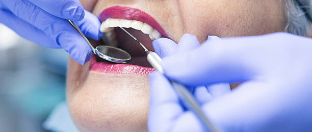 Best Emergency Treatment for Dental Infections or Abscesses in The Village Of Indian Hill, OH
